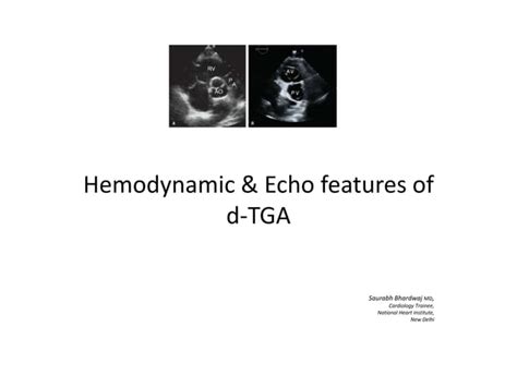 D tga, echo & hemodynamic features of | PPT