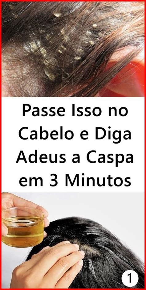 Passe Isso No Cabelo E Diga Adeus A Caspa Em Minutos Caspa