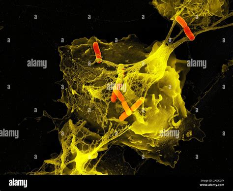 Neutrophil Cell Trapping Bacteria Coloured Scanning Electron