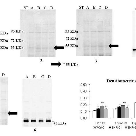 Vacht Western Blots Analysis In Frontal Cortex Blot 1 Striatum Blot