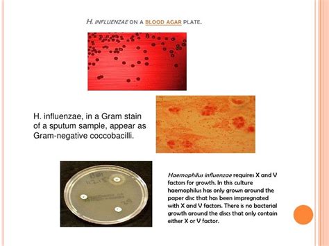 Haemophilus influenzae