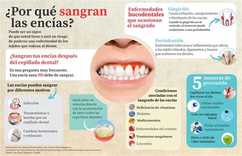 Enfermedades de las Encías Del sangrado a la pérdida de dientes