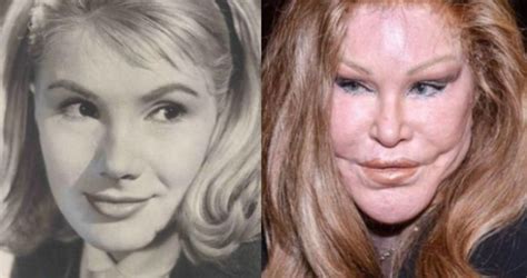 Used To Be Such A Beauty How The Famous Plastic Surgery Aficionado