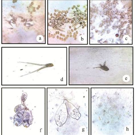 Relative Proportion Of Infection By Species Of Protozoan Parasites In Download Scientific