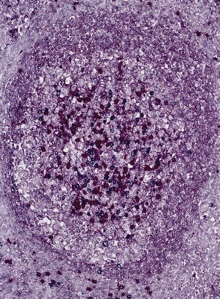 Histological Structure Of Lymph Node - Infoupdate.org