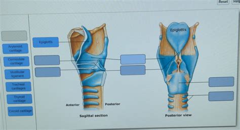 Solved Reset Helg Epiglottis Epiglottis Arytenoid Cartilage Chegg