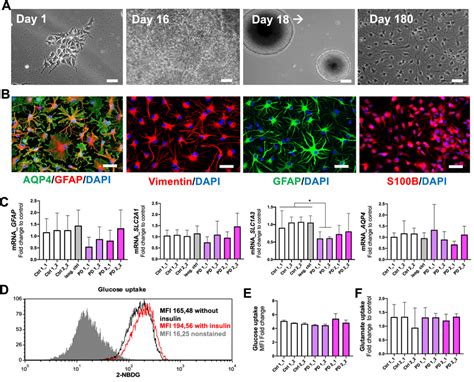 Differentiation And Characterization Of HiPSC Derived Astrocytes From