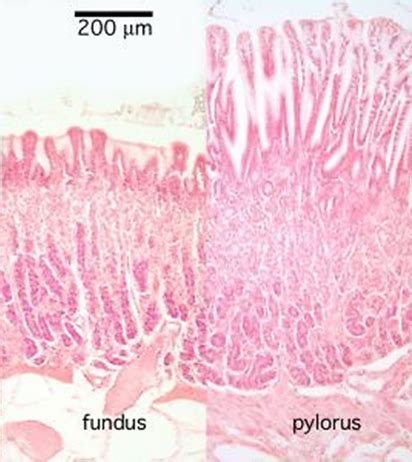 GI 12 H Pylori And PUD Flashcards Quizlet