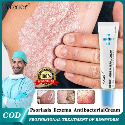 Yoxier Herbal Antibacterial Cream 20g For Skin Allergies And Ringworm