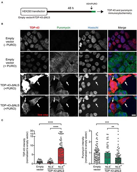 Frontiers Cytoplasmic Expression Of The Als Ftd Related Protein Tdp