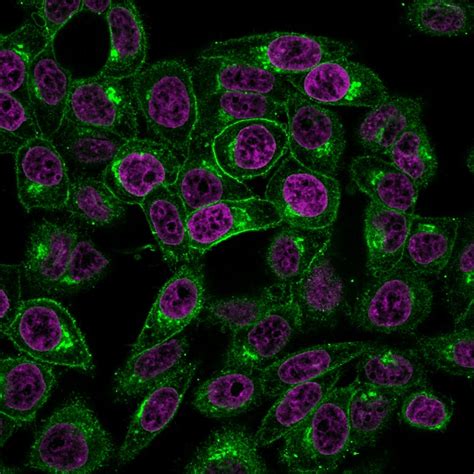 Beta 2 Microglobulin B2mbbm1 1mgml