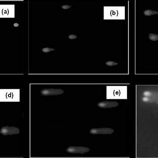 Comet Images After Alkaline Single Cell Gel Electrophoresis Followed By