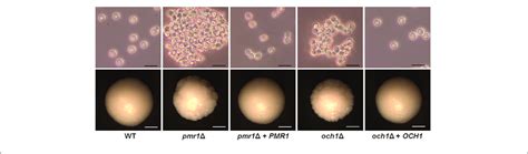 | Cell and colony morphology of Candida tropicalis pmr1 and och1 null ...