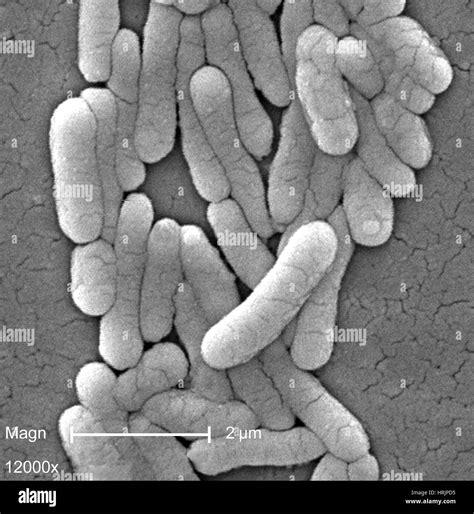 La Bacteria Salmonella Typhimurium Sem Fotografía De Stock Alamy