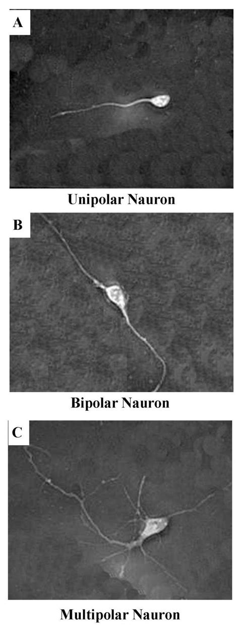 Types Of Prefrontal Cerebrocortical Neurons In Culture 400x