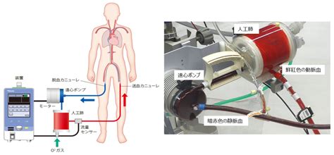 膜型人工肺 特徴 – 人工肺膜 表面処理 – 体外式膜型人工肺-cobetter – VTHJ