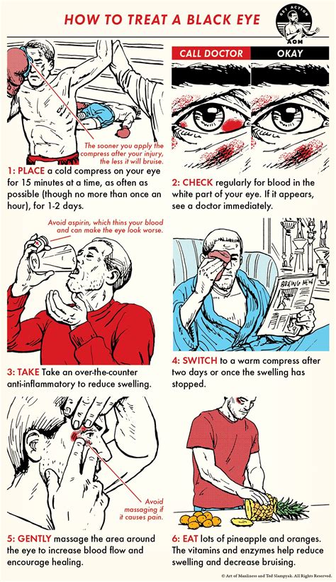 Skill of the Week: Treat Frostbite | Survival life hacks, Wilderness