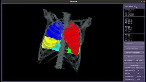 Lung Lobe Segmentation Youtube