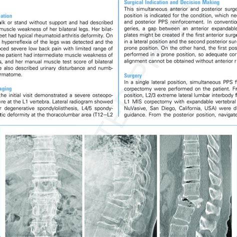 Preoperative Radiograms And Computed Tomography Ct A Download