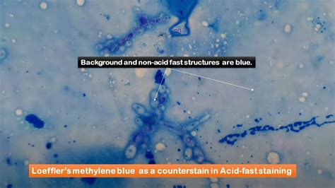 Loeffler Methylene Blue Stain Introduction Principle Composition Prepar