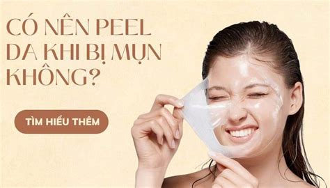 REVIEW Top 7 sản phẩm peel da trị mụn tại nhà hiệu quả an toàn cao