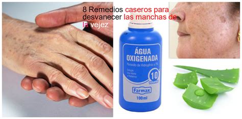 Remedios Caseros Naturales Para Las Manchas De La Edad Tratamiento De