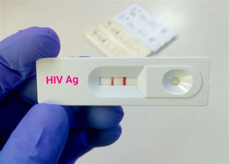 Hiv Test Results