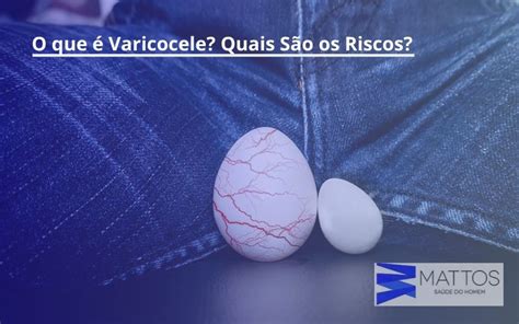 O Que Varicocele Quais S O Os Riscos Cl Nica Mattos