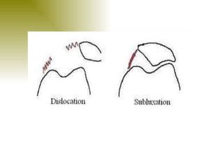 Dislocation of patella | PPT