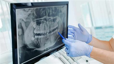 Importance Of Dental X Rays Dental Radiographs In Oro Valley