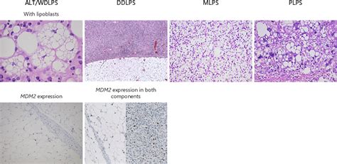 Established and Experimental Systemic Treatment Options for Advanced ...