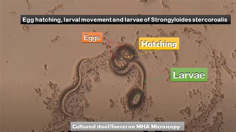 Strongyloidiasis Introductionlife Cycle Of Strongyloides Morphologysym