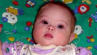 Parents Abandon Baby With Down Syndrome at Birth — Years Later, She’s a ...