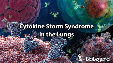 Cytokine Storm Syndrome in the Lungs - YouTube