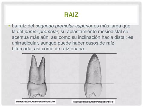 Segundo Premolar Superior Ppt