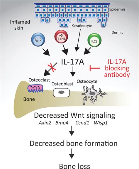 Chronic Skin Inflammation Leads To Bone Loss By Il 17mediated