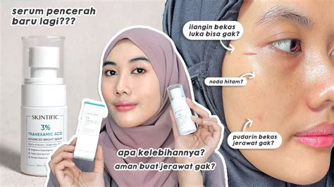 2 Minggu Pakai Skintific 3 Tranexamic Acid Bagus Kah Youtube