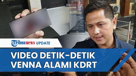 Video Venna Melinda Saat Dianiaya Ferry Irawan Dipamerkan Sang Adik