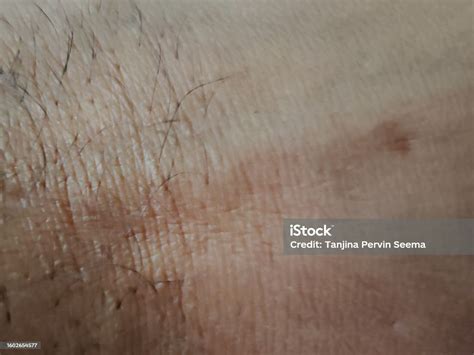 Human Body Skin Hand Skin Stock Photo - Download Image Now - Adult, Adults Only, Beauty Spa - iStock