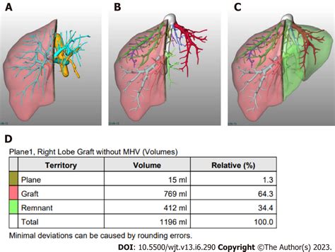 Liver Volumetric And Anatomic Assessment In Living Donor Liver