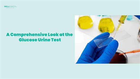 Can You Test Glucose In Urine at Roy Villarreal blog