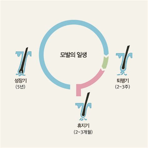 홍성재 박사의 탈모 의학 모발의 성장기를 짧게 만드는 Dht