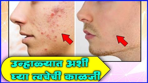 उन्हाळ्यात अशी घ्या त्वचेची काळजी 6 Best Summer Skin Care Tips Skin