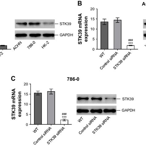 Suppression Of Stk39 Expression By Rnai A Stk39 Mrna Left And