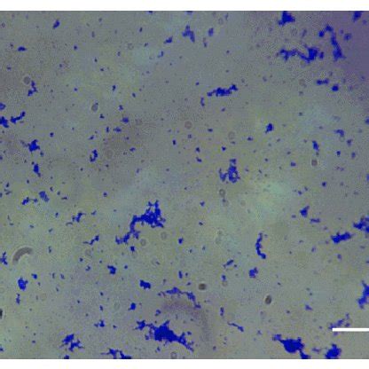 A) Cultured spirochetes from patient 3 tissue samples, 1000X darkfield ...