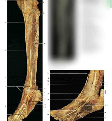 muscles loge postérieure profonde 2 Diagram Quizlet