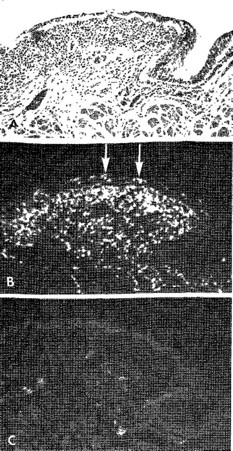 Figure 4 From IDENTIFICATION BY IMMUNOFLUORESCENCE OF EOSINOPHIL