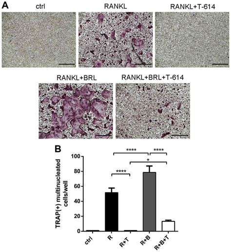 Iguratimod Prevents Ovariectomyinduced Bone Loss And Suppresses