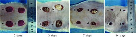 Representative images show the progression in healing of a ...