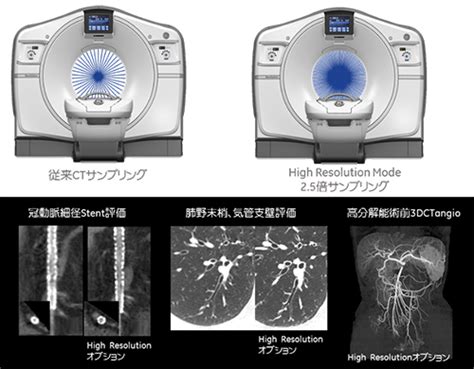 Revolution Hd Ct 64列128スライス Geヘルスケア・ジャパン株式会社